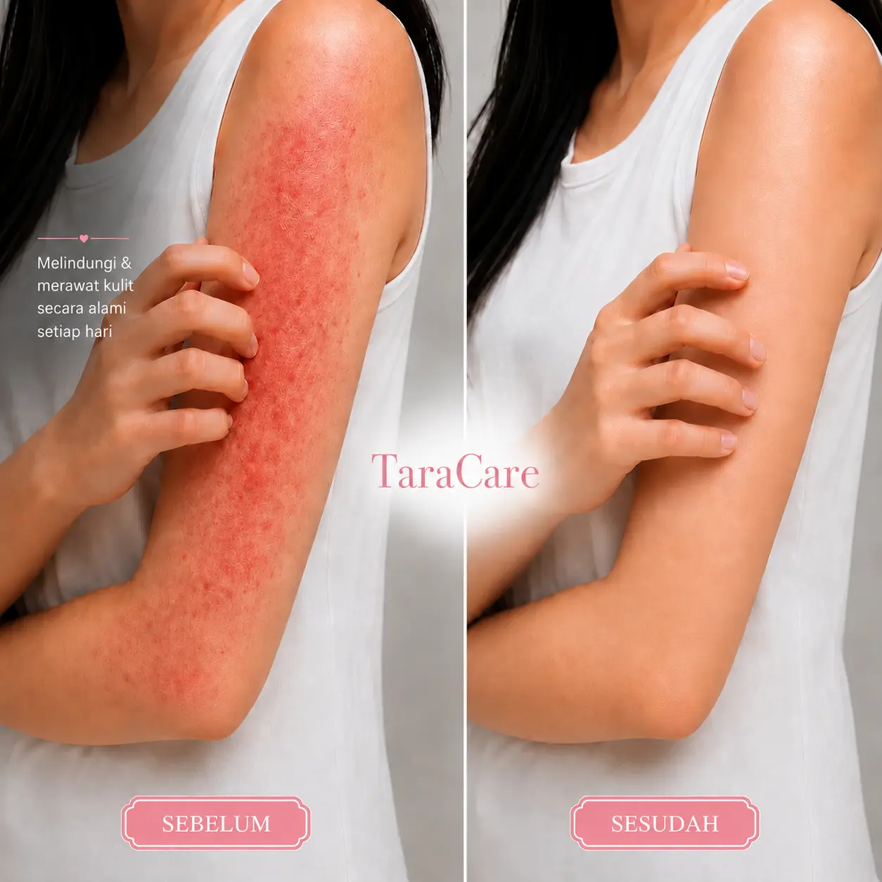 Before After Kulit